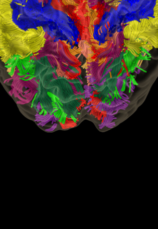 black background with colorful brain at the top