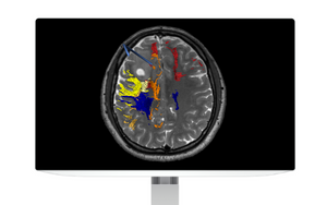 monitor with colourful brain on black background