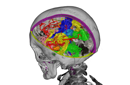 rendered skull with colourful brain and blood vessels