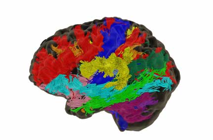 colorful brain