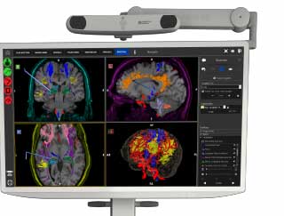 Large monitor with images of a brain scan and colorful tracts and red blood vessels