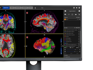 monitor with colorful brains