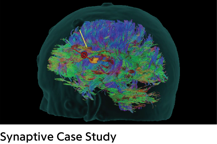 Colourful brain