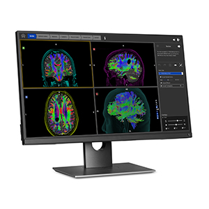 St. Tammany Parish and Ochsner Health System Bring BrightMatter™ to New Orleans