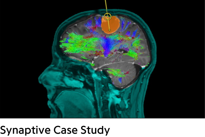 colorful brain with orange tumor