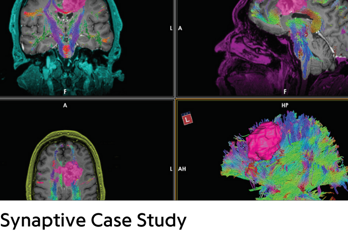 colorful brains