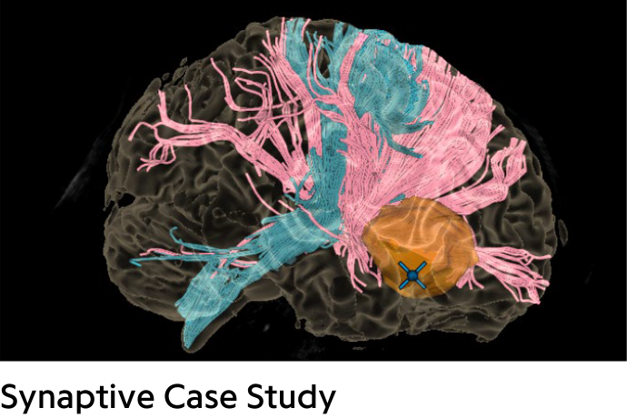 Colorful brain with orange tumor