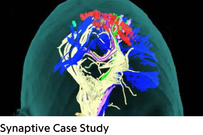 image of a important paths in brain